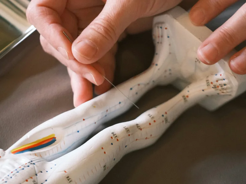 Acupuncture at ABC Chiropractic in Hudsonville
