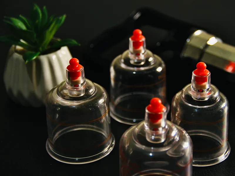 How Cupping Therapy works at ABC Chiropractic
