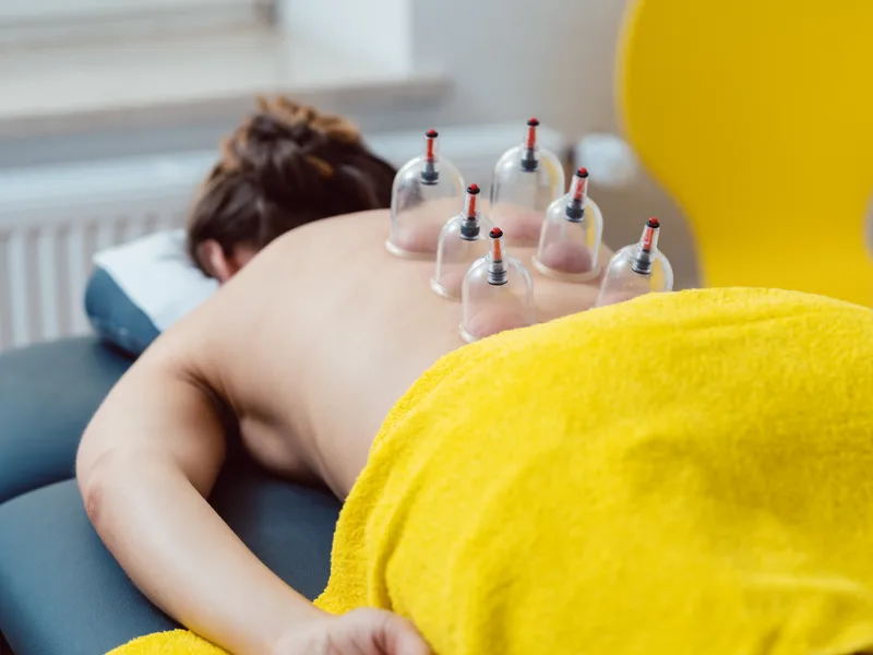 Cupping Therapy at ABC Chiropractic in Hudsonville