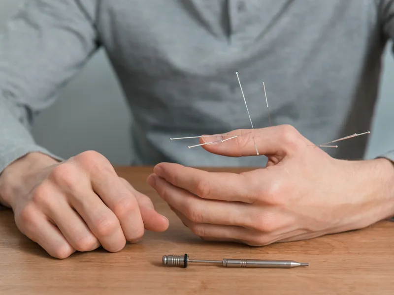 Dry Needling at ABC Chiropractic in Hudsonville